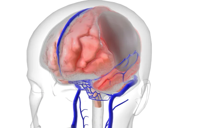 DR JONATHAN SURIEL CIRUGIA DE HEMATOMAS